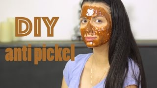 DIY anti pickel Maske Maske gegen Mitesser und Akne [upl. by Anidualc]