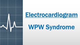 WPW syndrome Electrocardiogram [upl. by Patterman]