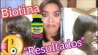 BIOTINA  Resultados Historia de mi transición Lismi Rodríguez 💜 [upl. by Dearr]