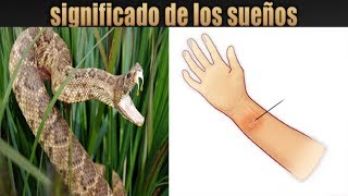 Significado de mordedura de serpiente en el sueño y que hacer guerra espiritual [upl. by Ariamat746]