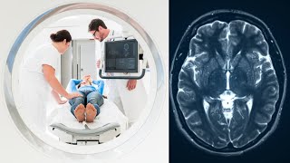 CT Scan  Everything You Need To Know About Computed Tomography [upl. by Urial]