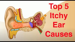 Top 5 Causes of Itchy Ears and Treatment Too [upl. by Christiane696]