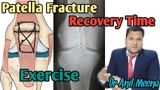 Patella Fracture Recovery Time after surgery  Patella Fracture Recovery Exercises In Hindi [upl. by Pack598]