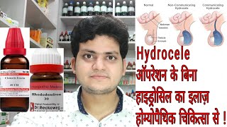 Hydrocele  Homeopathic medicine for Hydrocele  explain [upl. by Reider]