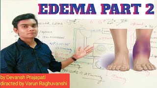 EDEMA PART 2PATHOGENESIS OF EDEMA INTRACELLULAR EDEMA [upl. by Martel]