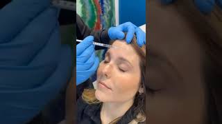 How to lift eyebrows with Botox  Best Eyebrows lift Botox in West Palm Beach Gardens  Dr Dahabra [upl. by Ariaz]