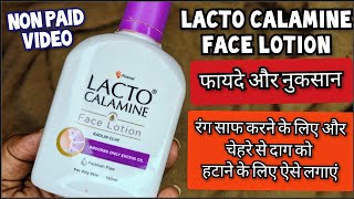 Lacto Calamine Face Lotion लैक्टो कैलामाइन लोशन  How to use lacto calamine lotion Review In Hindi [upl. by Conlan]