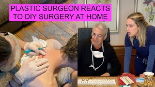 PLASTIC SURGEON REACTS to DIY CYST REMOVAL [upl. by Teufert]