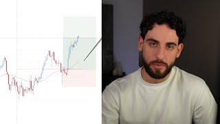 Trading Psychologist Reveals How To Trade Like The Top 1 [upl. by Yoshi114]