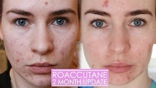 2 MONTH ROACCUTANE UPDATE  Side effects amp my skin now [upl. by Atisor]