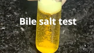 Bile Salt Test [upl. by Ellatsirhc]