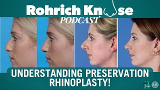 Understanding Preservation Rhinoplasty [upl. by Ylrebmik235]