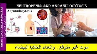 Lecture 23 Neutropenia and Agranulocytosis [upl. by Kanya]