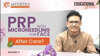 Microneedling with PRP Platelet Rich Plasma PRP Treatment For Face Acne Scars in Urdu [upl. by Eatnom228]