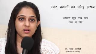 Skin Rashes  Signs Symptoms Home Remedies and Prevention Hindi [upl. by Egidius352]