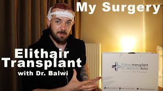 My Hair Transplant Part 10 The Surgery [upl. by Nomael]