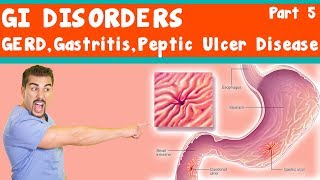 GI Disorders GERD Gastritis peptic ulcer Disease Part 5 [upl. by Jocelin]