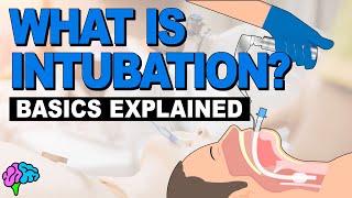 What is Intubation  The Basics Explained [upl. by Hgieliak855]