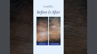 Visible result antihair loss tonic before amp after Cosmerna [upl. by Mia437]