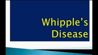 USMLE What you need to know about Whipples Disease by usmleTeam [upl. by Lipkin283]