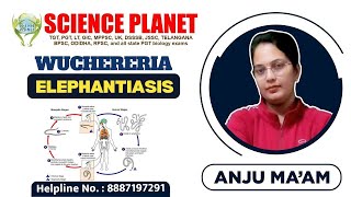 WUCHERERIA ELEPHANTIASIS II BY ANJU MAM II SCIENCE PLANET II [upl. by Almallah]