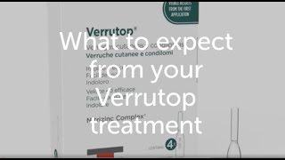 Verrutop Verruca and Wart treatment What to expect at your consultation [upl. by Schweitzer230]