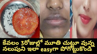 remove spotsdark black patches around mouth in 3days naturallysravs [upl. by Kinny]