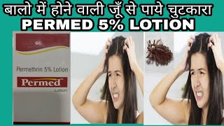 Permed Lotion full review in Hindi  परमेड लोशन रेवयु इन हिंदी [upl. by Reinald81]