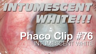 Phaco Clip 76  Intumescent White [upl. by Eeldivad]