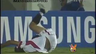 Terrible lesion de tibia y perone de un jugador del Sevilla fc juvenil [upl. by Akeret]