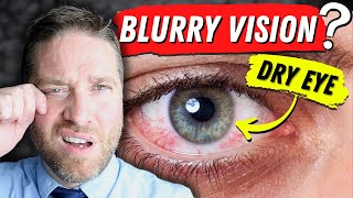 Why Dry Eyes Cause Blurry Vision  3 Reasons And 3 Home Remedies [upl. by Hey]