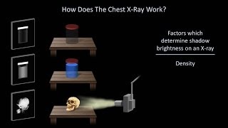 How to Interpret a Chest XRay Lesson 1  An Introduction [upl. by Arie382]