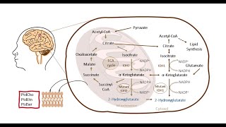 IDH1 mutation histology and treatment of tissue metabolites in diffuse glioma [upl. by Sidras]