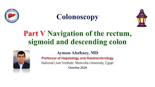 Colonoscopy Part V Navigation of the rectum sigmoid and descending colon 2024 [upl. by Dominick]