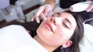 Limpieza Facial Profunda Profesional [upl. by Aleiram669]