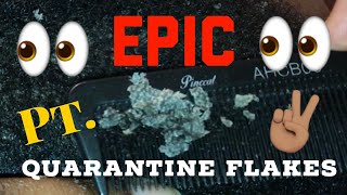 Thick amp Large Quarantine Flakes Part 2  Scratchers Anonymous ASMR Dandruff Flakes in Quarantine [upl. by Anilyx]