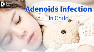 Infected adenoids in children Signs Symptoms Diagnosis  Dr Satish Babu K [upl. by Klina508]