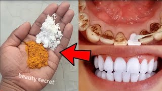 easy teeth whitening at home [upl. by Nonnaer]