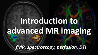 An Introduction to Advanced MRI techniques fMRI spectroscopy perfusion amp diffusion tensor imaging [upl. by Ainevuol606]