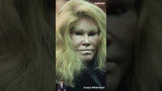 Jocelyn Wildenstein What happened after plastic surgery shorts [upl. by Norby547]