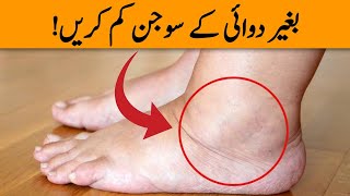 1 Vitamin To Eliminate Swollen Legs Feet and Ankles  Sujan Ka Ilaj  Dr YK [upl. by Nigel]