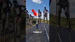 Kenapa mereka berjalan menggunakan tongkat‼️😱 [upl. by Sonaj21]