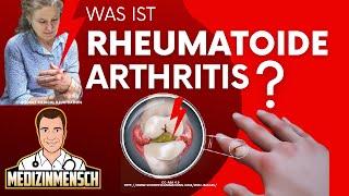 Rheumatoide Arthritis deutsch — Rheumatologe erklärt RHEUMA [upl. by Wojak]