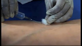 Phlebotomy venipuncture procedure Dr Sanjay D Deshmukh MD [upl. by Elenaj]