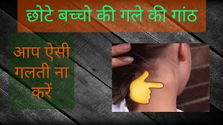 Neck cyst  Neck lump  Cervical lymphadenopathy   छोटे बच्चो की गले की गांठ  By Drvivek verma [upl. by Loriner]