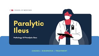 Causes Of Paralytic Ileus  Diagnosis  Treatment [upl. by Ariahs]