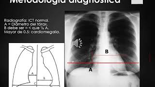 P Cardiaca IMAGENES [upl. by Nimsaj812]