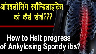 Ankylosing Spondylitis How to Halt Its progress II haltankylosingspondylitis [upl. by Cerveny]