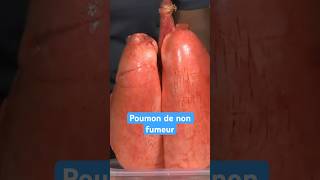 Poumon de fumeur VS non fumeur [upl. by Ayihsa]