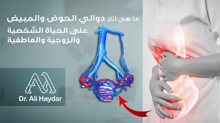 Pelvic Congestion Syndrome  Dr Ali Haydar  دوالي الحوض والمبيض [upl. by Sonya114]